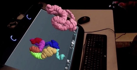 精準醫療新篇章 3D打印與虛擬現實融合開創外科手術新紀元